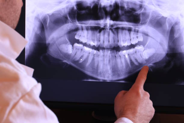 Best Emergency Root Canal Treatment in Brookfield, NJ