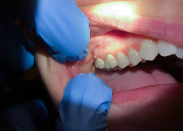Best Pediatric Emergency Dentist in Brookfield, NJ