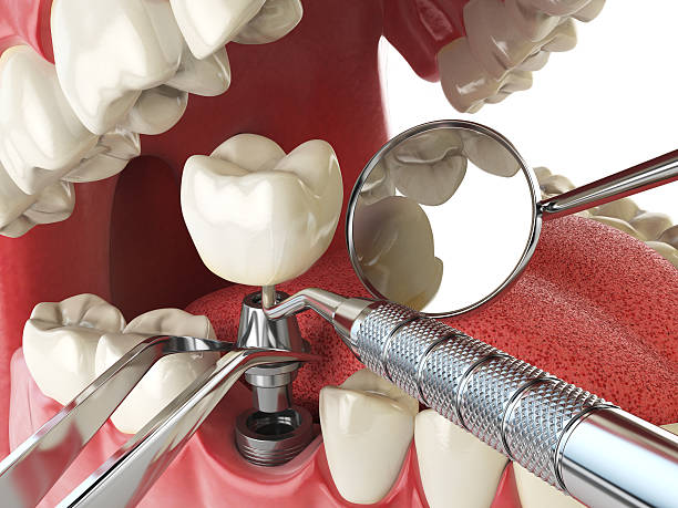 Best Emergency Dental Surgery in Brookfield, NJ